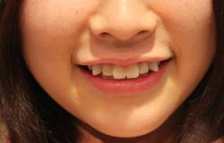 Сонник зубы, к чему снится зубы, во сне зубы